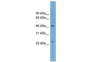 WB Suggested Anti-ATP8B2 Antibody Titration:  0. (ATP8B2 antibody  (N-Term))
