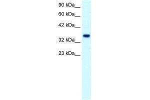Human Placenta; WB Suggested Anti-FOXF1 Antibody Titration: 2. (FOXF1 antibody  (C-Term))