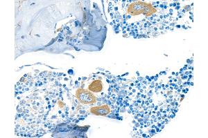 Immunohistochemistry (IHC) image for anti-Transforming Growth Factor, beta 1 (TGFB1) (AA 325-375) antibody (ABIN7449529)