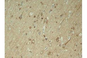 Immunohistochemical analysis of paraffin-embedded rat hippocampal region tissue from a model with Alzheimer (MAPT antibody  (pSer396))