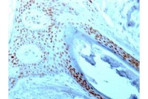 Formalin-fixed paraffin-embedded human skin stained with NCL antibody (364-5). (Nucleolin antibody)