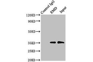 Western Blotting (WB) image for anti-Emerin (EMD) (AA 1-222) antibody (ABIN7151606)