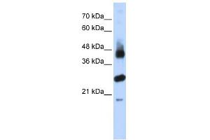 FBXL2 antibody used at 1 ug/ml to detect target protein. (FBXL2 antibody  (N-Term))