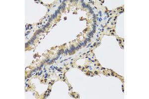 Immunohistochemistry of paraffin-embedded rat lung using IL25 antibody (ABIN5974535) at dilution of 1/100 (40x lens). (IL-25 antibody)