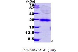 SDS-PAGE (SDS) image for Ras Homolog Gene Family, Member C (RHOC) (AA 1-190) protein (His tag) (ABIN667800)