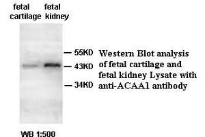 Image no. 2 for anti-Acetyl-CoA Acyltransferase 1 (ACAA1) antibody (ABIN791175) (ACAA1 antibody)