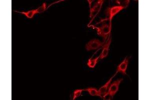 ABIN6275703 staining Hela by IF/ICC. (PTGR2 antibody  (Internal Region))