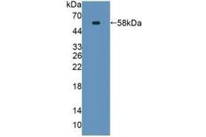 Detection of Recombinant SPTLC3, Mouse using Polyclonal Antibody to Serine Palmitoyltransferase, Long Chain Base Subunit 3 (SPTLC3) (SPTLC3 antibody  (AA 80-563))