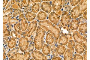 ABIN6263693 and ABIN6278598 at 1/100 staining Rat kidney tissue by IHC-P.