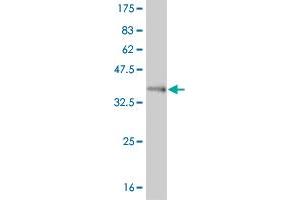 Western Blot detection against Immunogen (37. (FOXL1 antibody  (AA 132-240))
