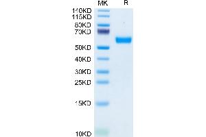 SDS-PAGE (SDS) image for CD83 (CD83) (AA 22-134) protein (Fc Tag) (ABIN7274261)