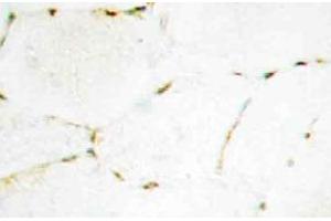 Immunohistochemistry (IHC) analyzes of Smad1/5/9 antibody in paraffin-embedded human skeletal muscle tissue. (SMAD1 antibody)