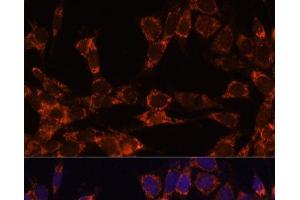 Immunofluorescence analysis of NIH-3T3 cells using UBE2F Polyclonal Antibody at dilution of 1:100. (UBE2F antibody)