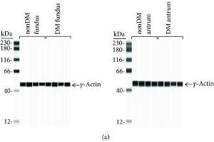 Western Blotting (WB) image for anti-Actin, gamma 1 (ACTG1) (N-Term) antibody (ABIN2855174)
