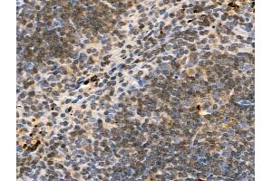 ABIN7093305 and ABIN7097324 at 1/100 staining Mouse spleen tissue by IHC-P. (TCP1 alpha/CCTA antibody  (pSer395))