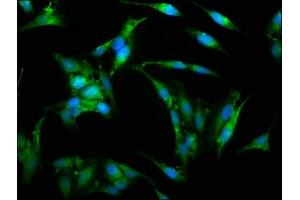 Immunofluorescence staining of Hela cells with ABIN7175826 at 1:150, counter-stained with DAPI. (WASP antibody  (AA 145-265))