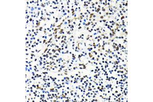 Immunohistochemistry of paraffin-embedded human tonsil using MKL1 antibody (ABIN6132380, ABIN6143855, ABIN6143858 and ABIN6224589) at dilution of 1:100 (40x lens). (MKL1 antibody  (AA 1-280))