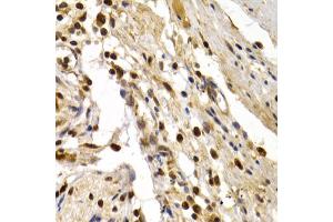 Immunohistochemistry of paraffin-embedded human colon injury using TFDP1 antibody (ABIN5973148) at dilution of 1/200 (40x lens). (DP1 antibody)