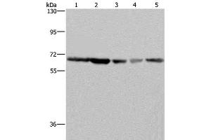 Western Blot analysis of K562, Hela, LoVo, 293T and Raji cell using GNL3 Polyclonal Antibody at dilution of 1:300 (Nucleostemin antibody)