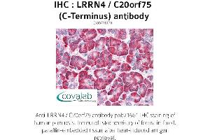 LRRN4 antibody  (C-Term)