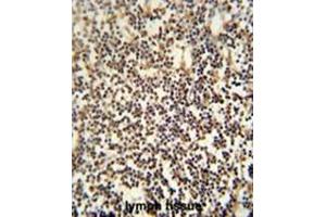 C12orf48 antibody (C-term) immunohistochemistry analysis in formalin fixed and paraffin embedded human lymph tissue followed by peroxidase conjugation of the secondary antibody and DAB staining. (PARPBP antibody  (C-Term))