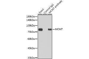 Immunoprecipitation analysis of 300 μg extracts of HeLa cells using 3 μg MCM7 antibody (ABIN7268544). (MCM7 antibody)