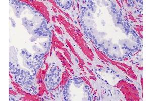 Human Prostate: Formalin-Fixed, Paraffin-Embedded (FFPE) (ACTG2 antibody  (N-Term))