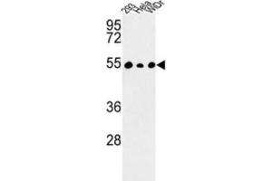 Western Blotting (WB) image for anti-Protein Phosphatase 1, Regulatory Subunit 36 (PPP1R36) antibody (ABIN3003992) (PPP1R36 antibody)