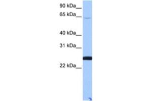 Western Blotting (WB) image for anti-Zinc Finger Protein 570-like (LOC344065) antibody (ABIN2463395) (ZFP 570-like antibody)