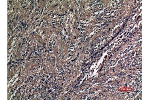 Immunohistochemistry (IHC) analysis of paraffin-embedded Human Ovary, antibody was diluted at 1:100. (A1BG antibody  (Internal Region))