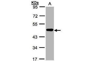 WB Image Sample(30 ug whole cell lysate) A:MOLT4 , 10% SDS PAGE antibody diluted at 1:1000 (MEK2 antibody)