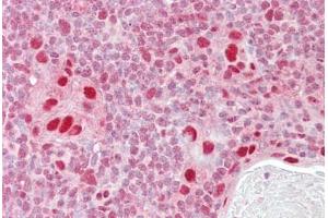 Anti-MSH5 antibody IHC staining of human thymus. (MSH5 antibody  (AA 508-519))