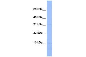 WB Suggested Anti-C18orf32 Antibody Titration: 0. (C18orf32 antibody  (Middle Region))