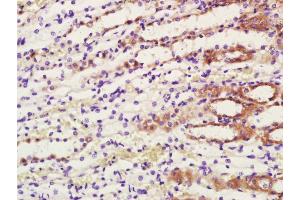 Paraformaldehyde-fixed, paraffin embedded rat kidney; Antigen retrieval by boiling in sodium citrate buffer (pH6. (COX1 antibody  (AA 401-500))