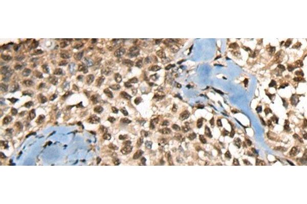 CCDC12 antibody