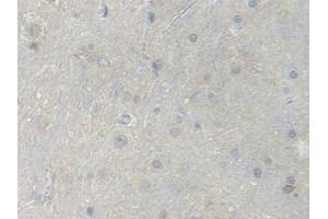 Detection of PFKM in Rat Spinal cord Tissue using Polyclonal Antibody to Phosphofructokinase, Muscle (PFKM) (PFKM antibody  (AA 2-390))