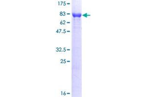 Phosphoglucomutase 1 Protein (PGM1) (AA 1-562) (GST tag)