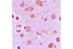 Immunohistochemical analysis of Synaptotagmin staining in human brain formalin fixed paraffin embedded tissue section. (Synaptotagmin antibody  (Center))