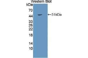 Western blot analysis of the recombinant protein.