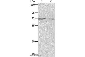 Western blot analysis of A375 and A431 cell, using PTPN6 Polyclonal Antibody at dilution of 1:500 (SHP1 antibody)