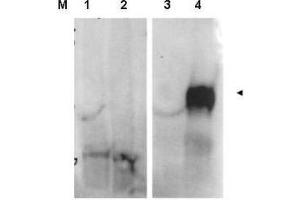 Image no. 1 for anti-Fibroblast Activation Protein, alpha (FAP) (Internal Region) antibody (ABIN1101478)