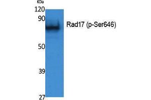 Western Blotting (WB) image for anti-RAD17 (RAD17) (pSer646) antibody (ABIN3183071) (RAD17 antibody  (pSer646))