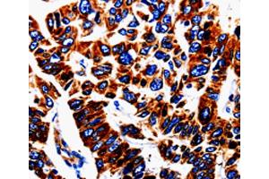 Immunohistochemistry (IHC) image for anti-Urotensin 2 (UTS2) antibody (ABIN5543194) (Urotensin 2 antibody)