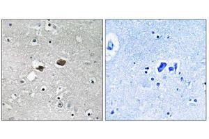Immunohistochemistry analysis of paraffin-embedded human brain tissue, using TIGD3 antibody. (TIGD3 antibody  (C-Term))