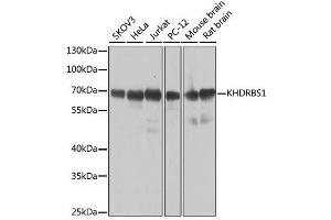 Western blot analysis of extracts of various cell lines, using KHDRBS1 antibody.