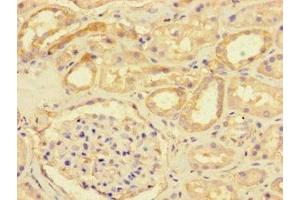 Immunohistochemistry of paraffin-embedded human kidney tissue using ABIN7149746 at dilution of 1:100 (DSE antibody  (AA 23-270))