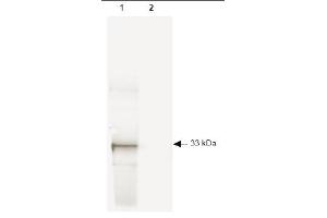 Western blot of GFP recombinant protein detected with ABIN116749. (GFP antibody)