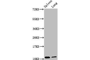 Western Blot Positive WB detected in: Mouse spleen tissue, Mouse lung tissue All lanes: S100a8 antibody at 3. (S1A8 (AA 2-89) antibody)