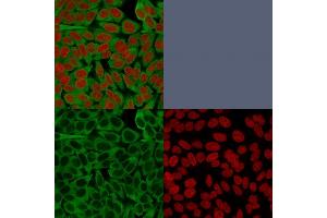 Confocal immunofluorescence image of HeLa cells using Fascin-1 Mouse Monoclonal Antibody (FSCN1/416). (Fascin antibody)