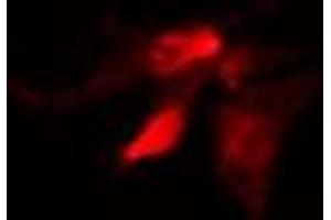 ABIN6279834 staining Hela by IF/ICC. (SLC6A11 antibody  (Internal Region))